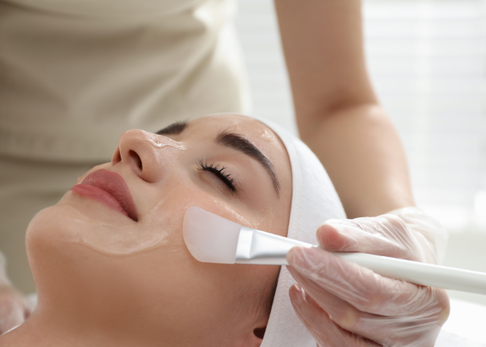 Kvinder der modtager acnelan / blemiderm peeling