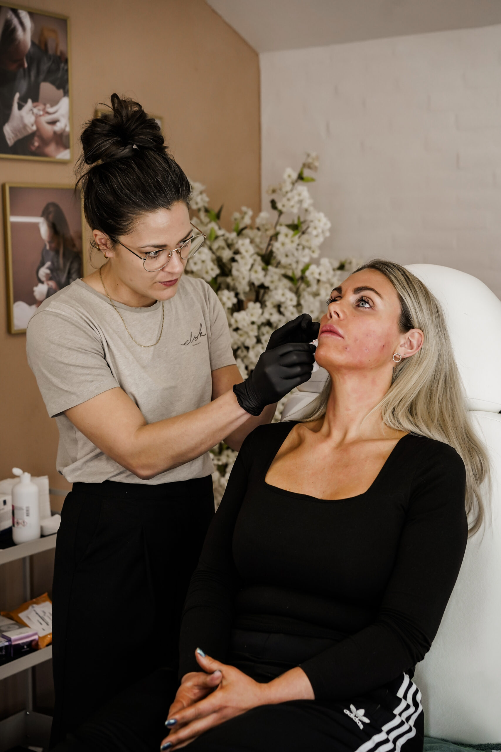 Botox-behandling hos Skinperfection